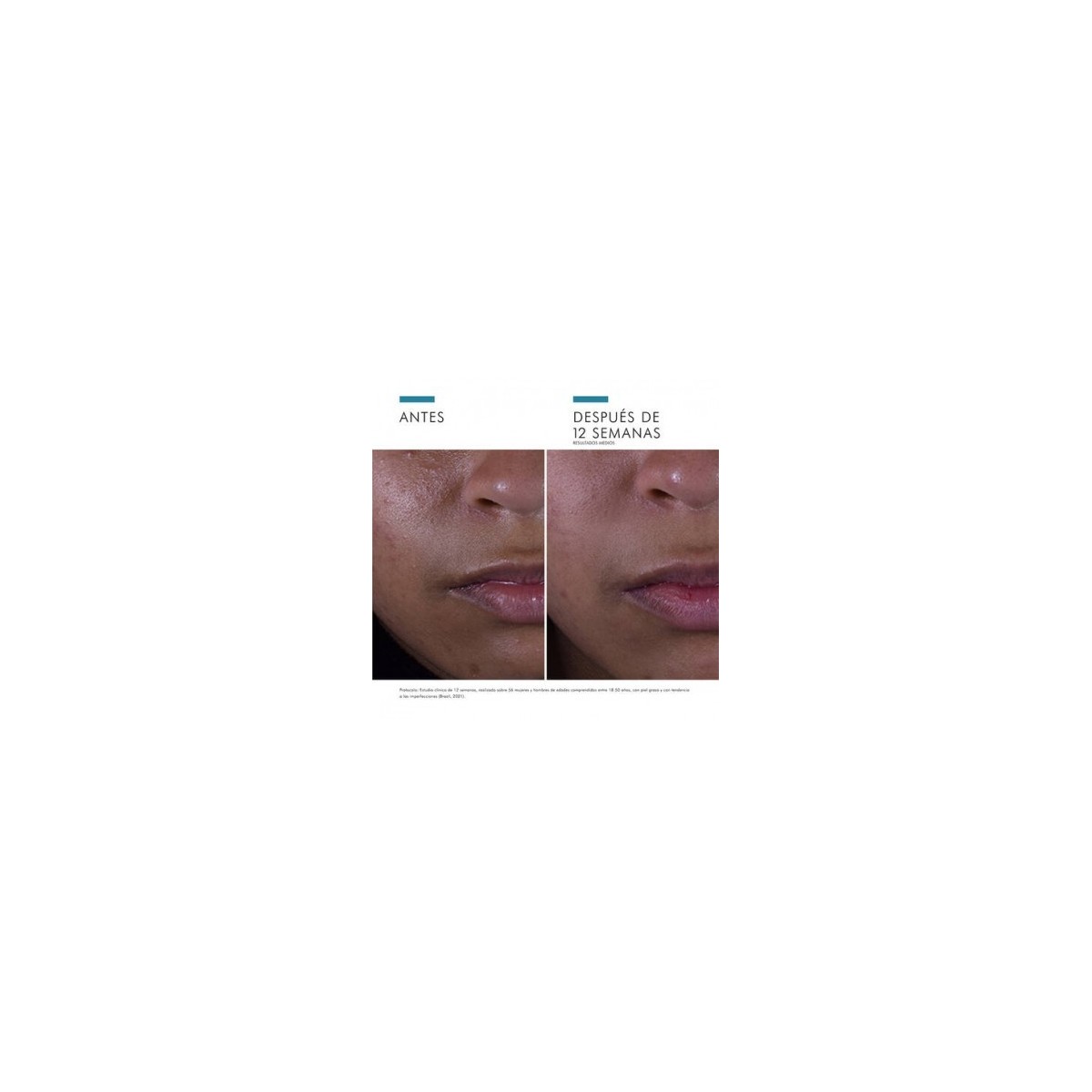 SKINCEUTICALS SILYMARIN CF 1 ENVASE 30 ML