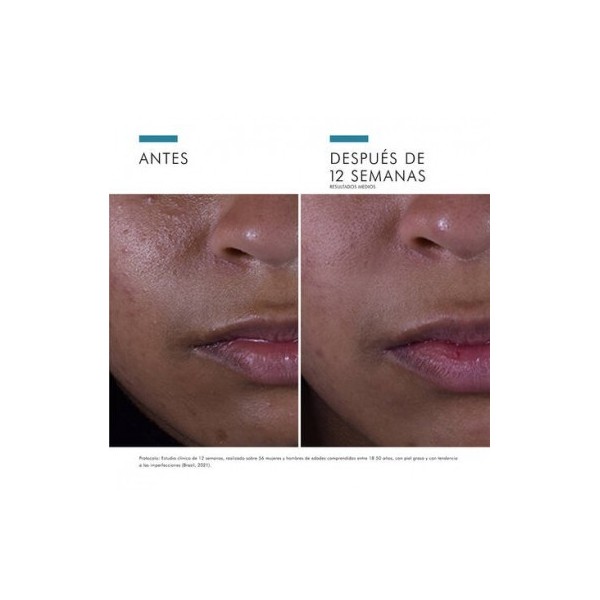 SKINCEUTICALS SILYMARIN CF 1 ENVASE 30 ML