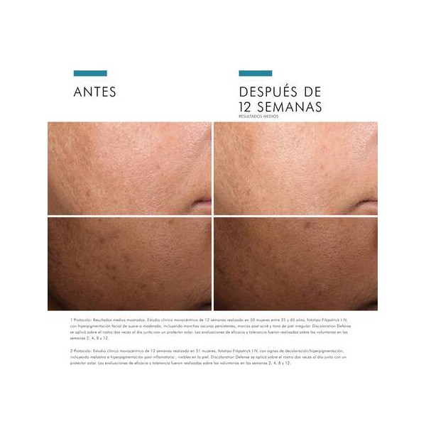 SKINCEUTICALS DISCOLORATION DEFENSE  1 ENVASE 30 ML