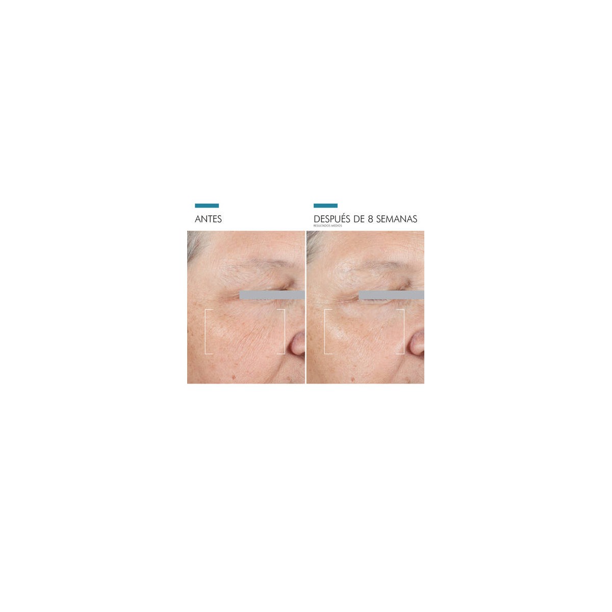 SKINCEUTICALS A.G.E. INTERRUPTER ADVANCED EYE 1...