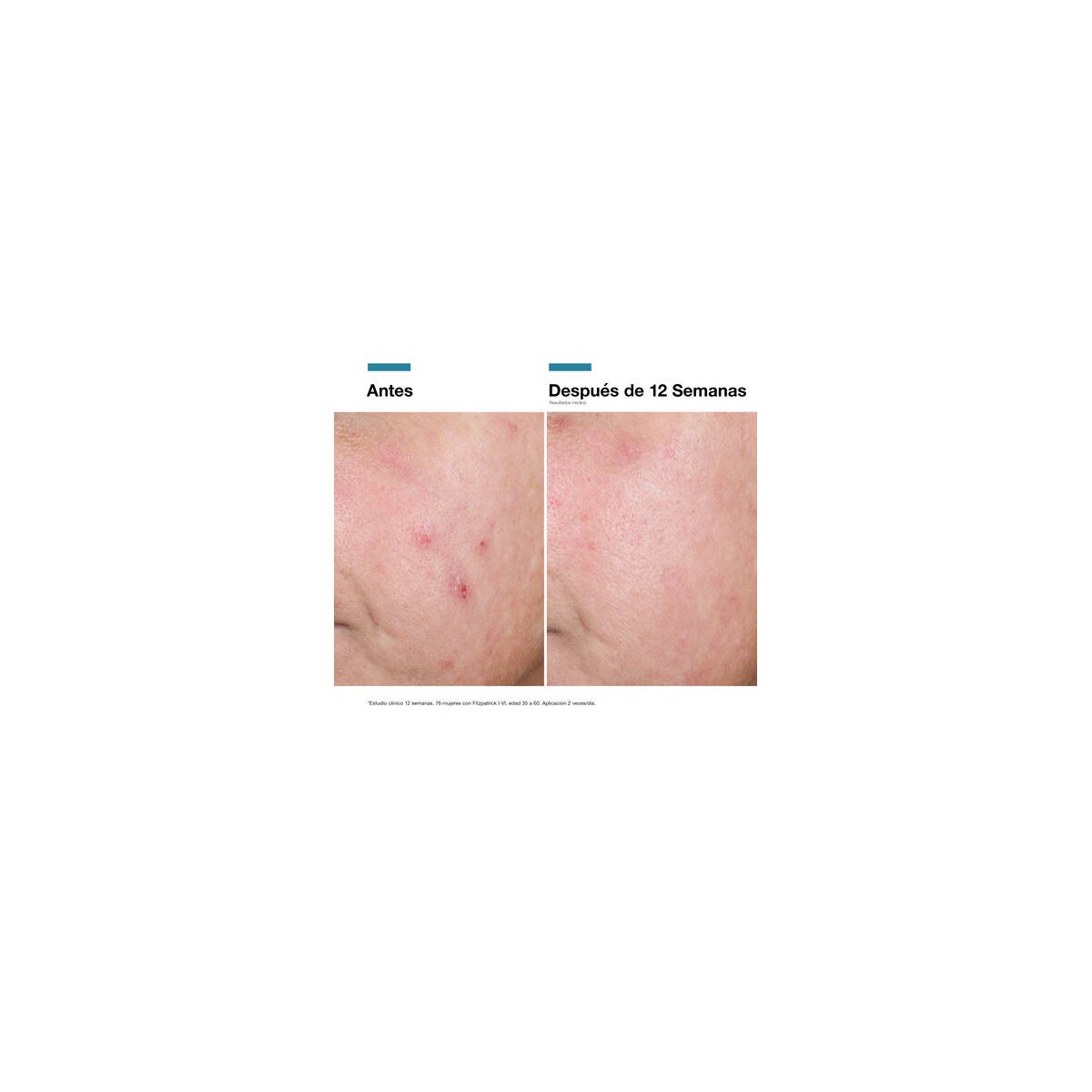 CREMA REPARADORA ADVANCED RGN-6 50 ML...