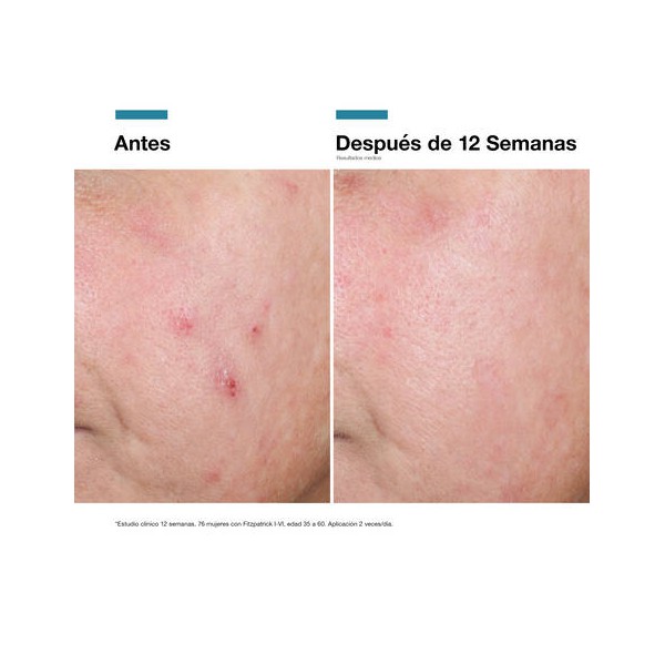 CREMA REPARADORA ADVANCED RGN-6 50 ML SKINCEUTICALS
