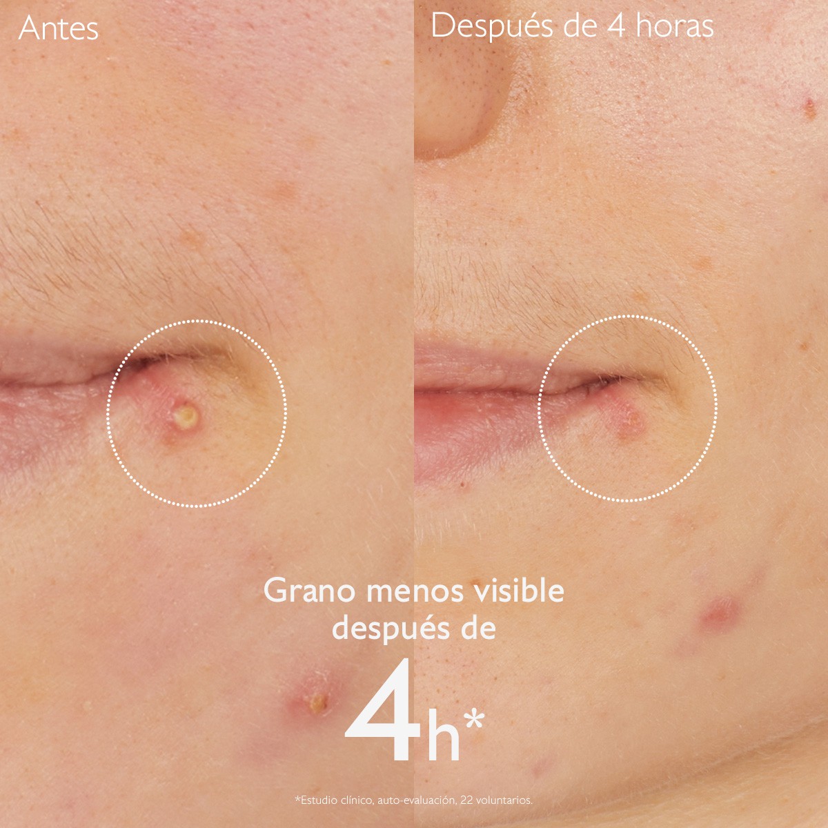 STOP GRANOS SALICILICO VINOPURE 15 ML CAUDALIE