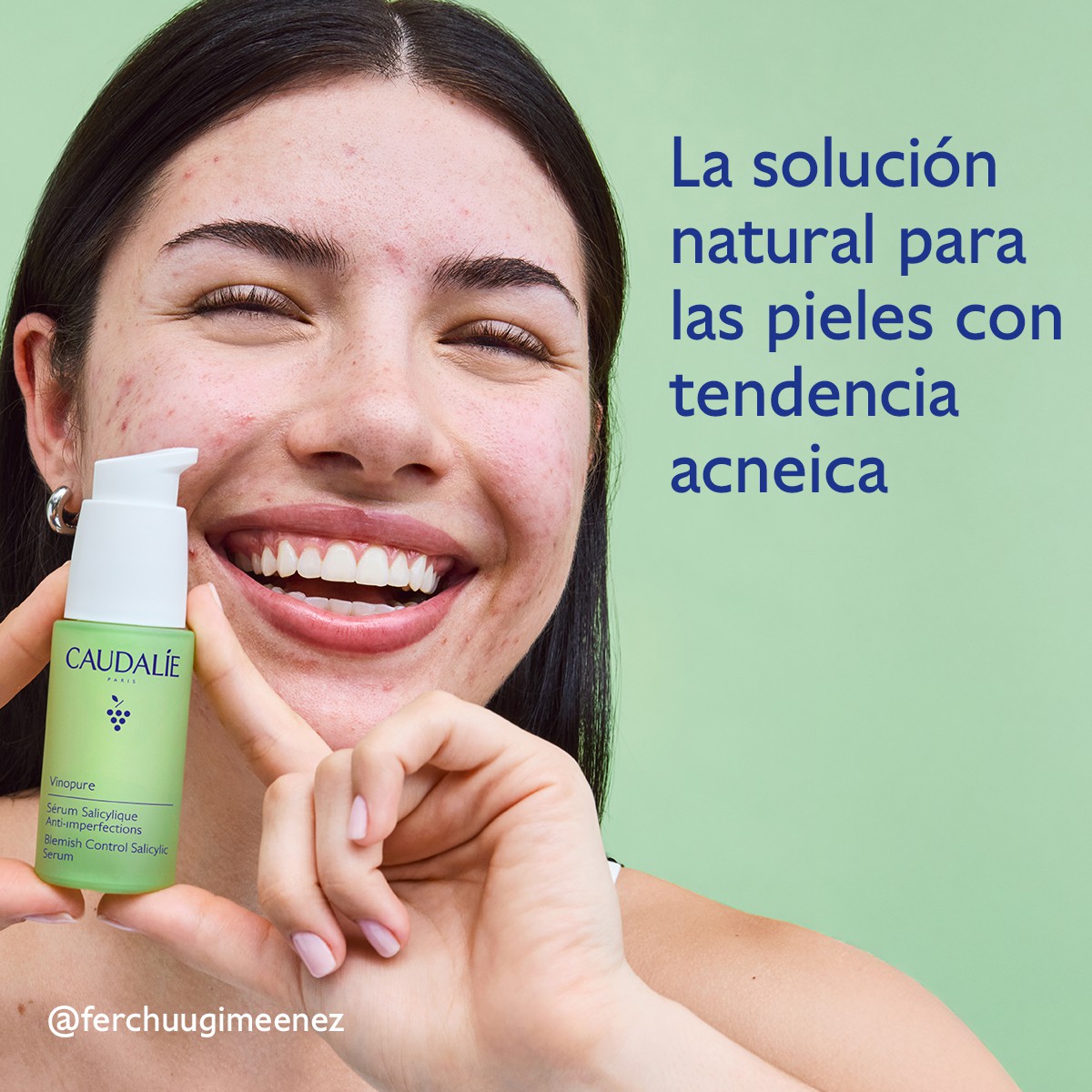 SERUM INFUSION ANTI-IMPERFECCIONES VINOPURE...