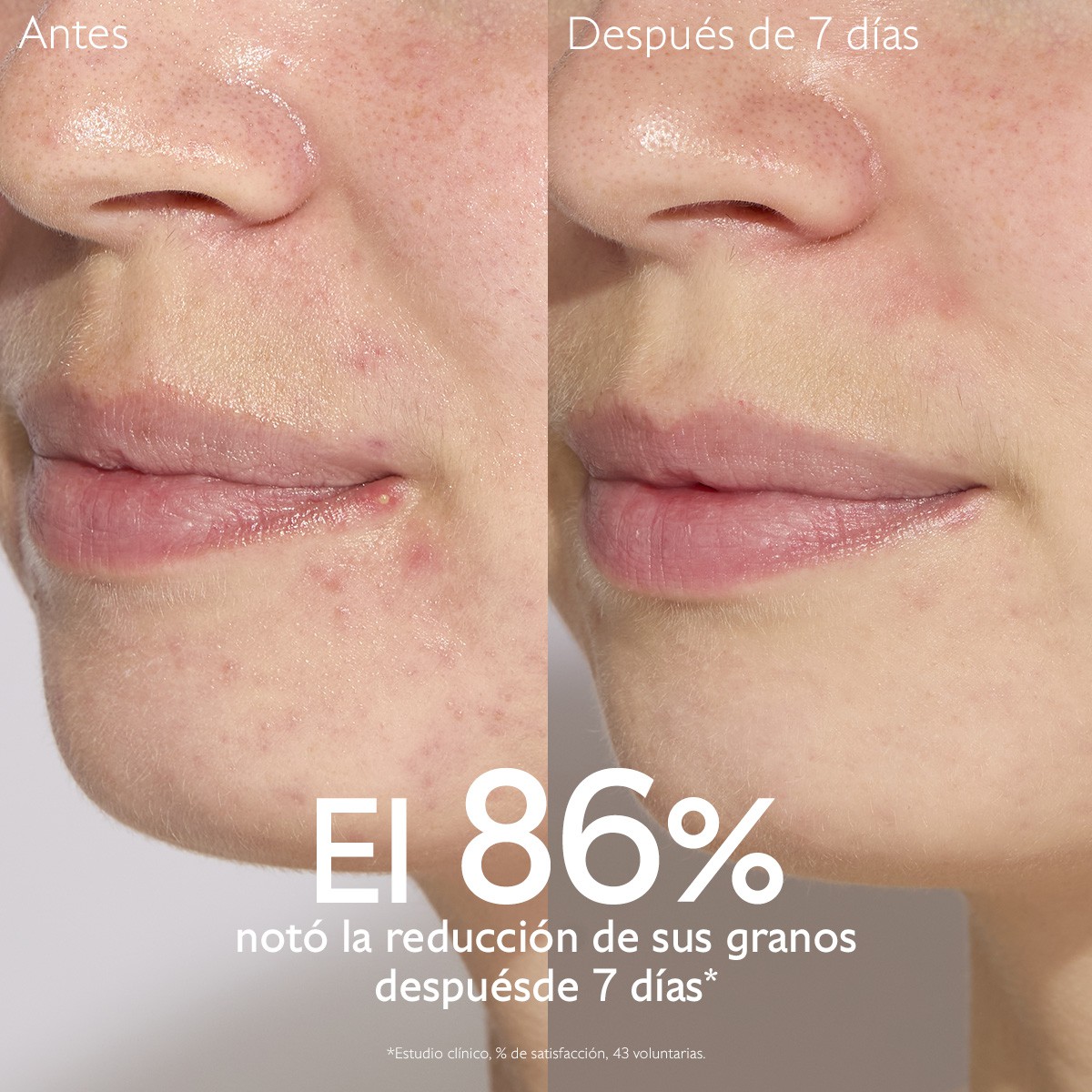SERUM INFUSION ANTI-IMPERFECCIONES VINOPURE...