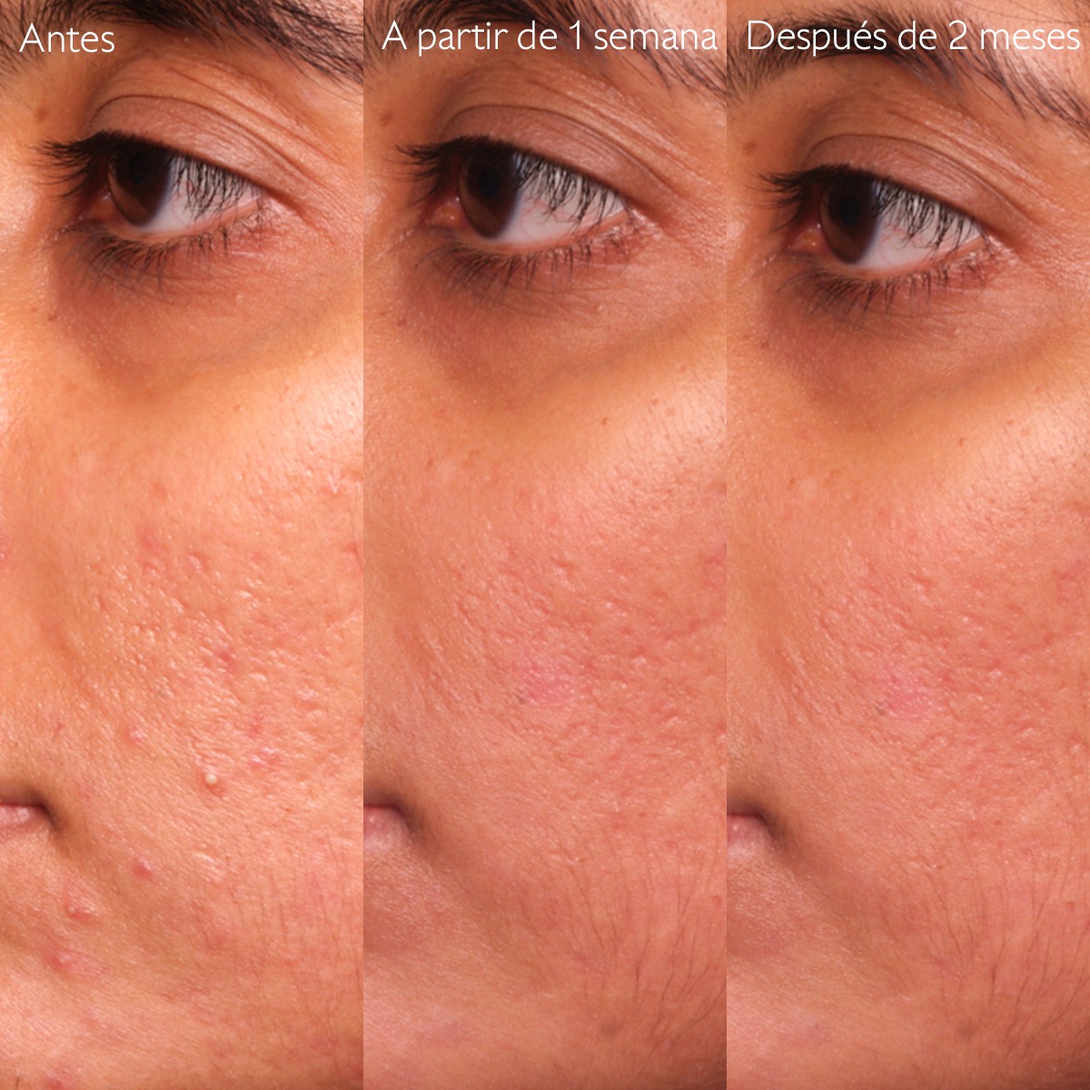 SERUM INFUSION ANTI-IMPERFECCIONES VINOPURE...