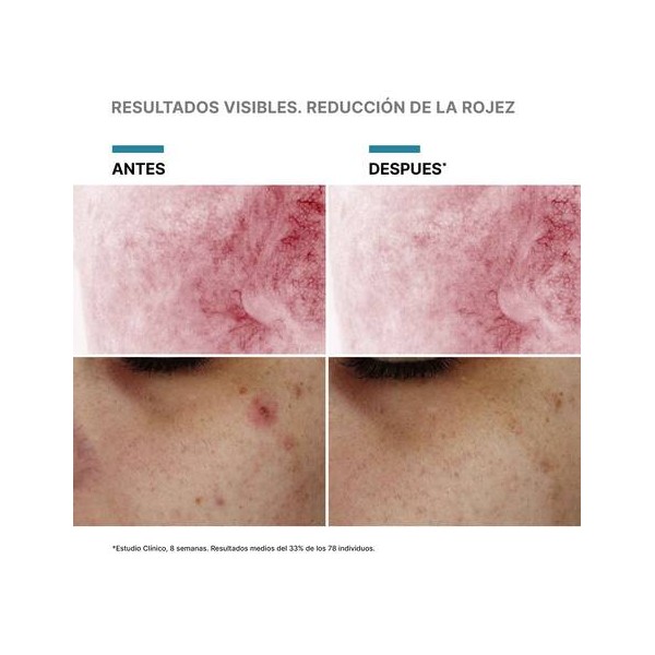 SKINCEUTICALS PHYTO CORRECTIVE WITH PDRN 1 ENVASE 30 ML